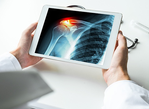 Saint Cloud holistic medicine doctor holding tablet with x ray of injured shoulder